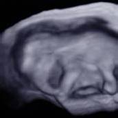 Erstes Bild von Elefantenbaby