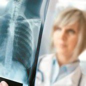 Strengere Rauchverbote entlasten Krankenhäuser