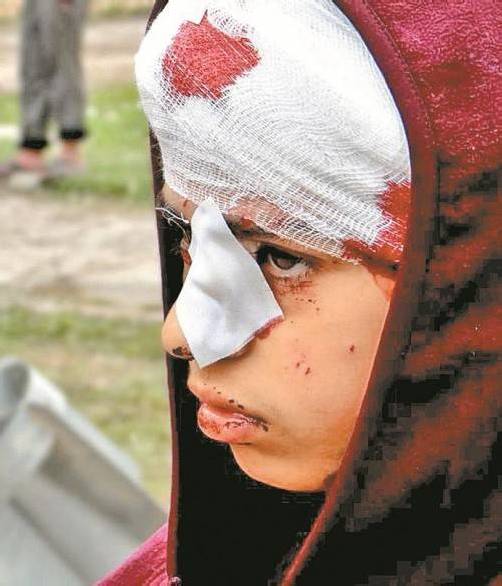 Bürgerkrieg in Syrien: Verletztes Kind in Aleppo. Foto: dapd