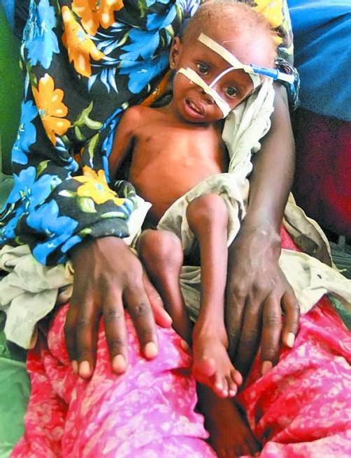 Hunger wird durch Nahrungsmittelspekulation verstärkt. Foto: RTS