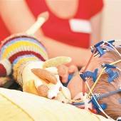 Fortschritt bei Epilepsie-Behandlung