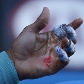 Nadals Hand ist eine einzige Wunde