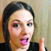 Blaues Auge als Andenken