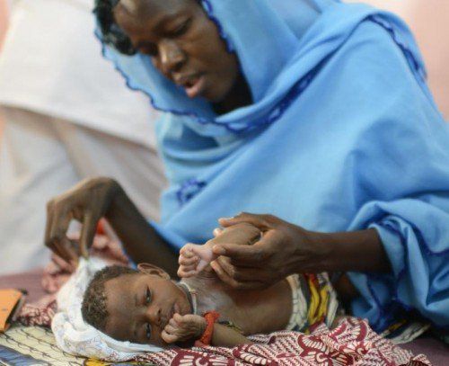 Im Senegal sind 27 Prozent aller Kinder unter fünf Jahren chronisch unterernährt. foto: APA