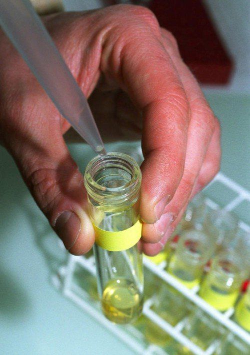 Teure Arzneimittelforschung, sündteure Pharma-Übernahmen: Medikamentenpreise treiben die Krankenkassen ins Minus. FOTO:PANORAMIC