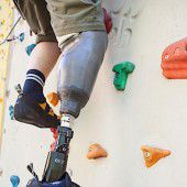 Mitfühlende Beinprothese verschafft neue Hoffnung