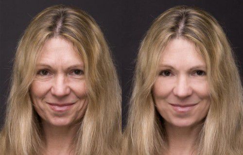 Das biologische Alter unterscheidet sich laut Forschern bereits in relativ jungen Jahren sehr stark.