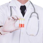 Ein akutes Alarmzeichen: Blut im Harn