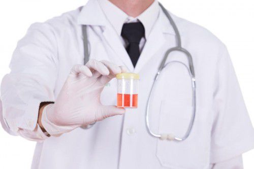Blut im Harn: Da die Hämaturie nur ein Krankheitszeichen ist, muss nicht nur die Hämaturie, sondern auch deren Ursache therapiert werden.