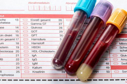 Über 60 Prozent aller medizinischen Diagnosen werden durch die Laboranalysen von Blut- und anderen Körperflüssigkeiten gestellt.