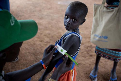 EIn UNICEF-Mitarbeiter untersucht einen Jungen auf Anzeichen von Unterernährung.  Foto: AP