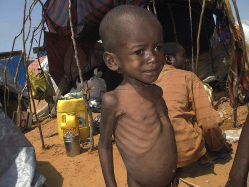 Vor allem Kinder in West- und Zentralafrika leiden unter den Lebensumständen. AP