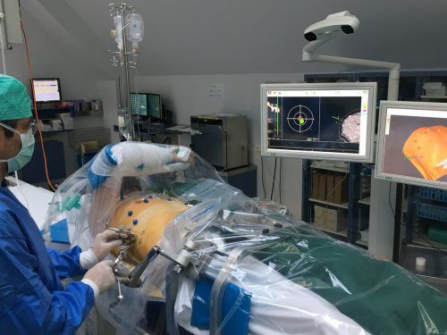 Präzise werden die Lebertumore von außen angesteuert. Foto: uniklinik innsbruck