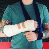 Chartstürmer Ed Sheeran verletzt sich bei Fahrradunfall