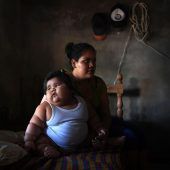 Baby bringt 28 Kilo auf die Waage