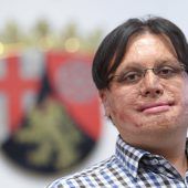 Die Ramstein-Narben bleiben