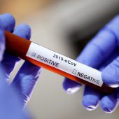 Coronavirus: Vorhersagen über Epidemie-Verlauf „unmöglich“