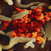 Coronavirus-Epidemie soll sich erst Ende April stabilisieren