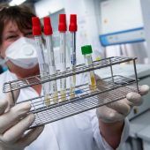 Mit Corona Schritte nach vor und zurück