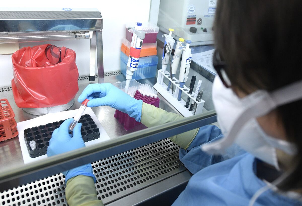 Das Marburg-Virus kann hohes sogenanntes hämorrhagisches Fieber und Symptome wie Muskelschmerzen, Bauchkrämpfe, Durchfall und blutiges Erbrechen auslösen. ⇒apa