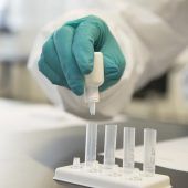 In den Testkojen ist kein Platz mehr frei