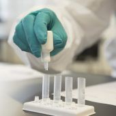 Beharren auf Test beim Hausarzt