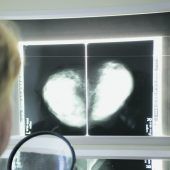Studien als Chance bei Frauen gefragt