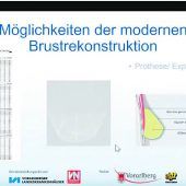 Wichtiger Beitrag zur Brustgesundheit