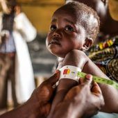 Millionen Menschen droht wegen Mittelkürzungen extremer Hunger