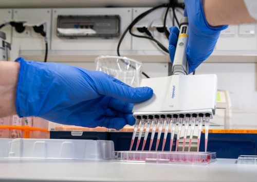 Die Forscher wollen nun einen Impfstoff kreieren, der möglichst direkt auf den HA-Anker verschiedener Grippestämme abzielt. apa
