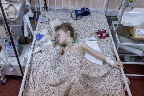 Der dreijährige Dima wurde beim Beschuss von Mariupol verletzt.