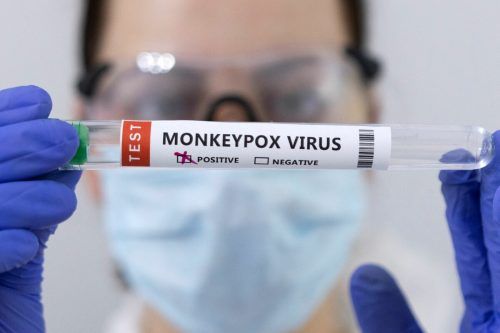 Affenpocken-PCR-Tests geben Aufschluss über eine mögliche Infektion mit dem Virus.
reuters