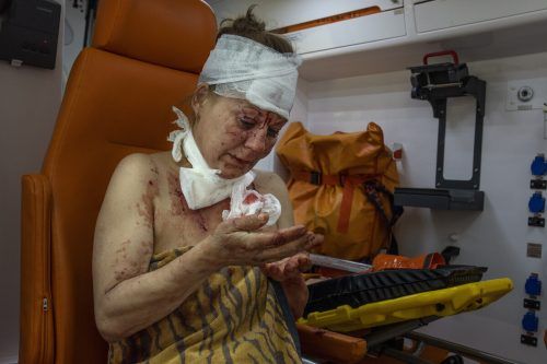 Eine Frau aus Kramatorsk lässt ihre Wunden in einem Krankenwagen versorgen. In der Stadt wurden mehrere Siedlungen mit Artillerie beschossen.  AP