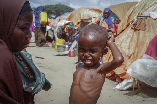 Weltweit stirbt alle dreizehn Sekunden ein Kind an den Folgen von Hunger.  ap