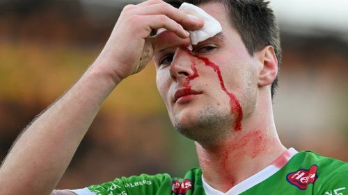 Auch eine Platzwunde über dem Auge konnte Stefano Surdanovic nicht stoppen. Der 24-Jährige war trotzdem Austrias Bester. gepa