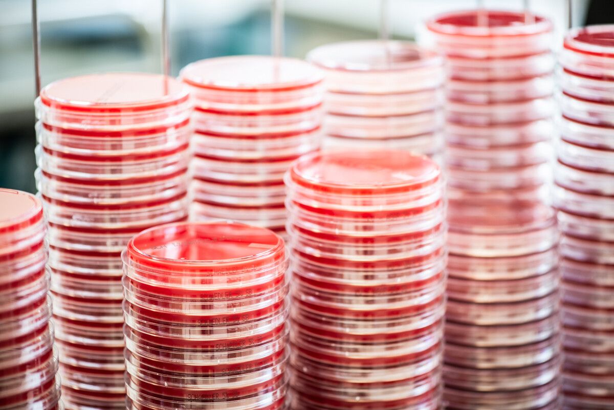 Die Bestimmung, welcher Phage bei welchem Patienten infrage kommt und wirkt, wird als sehr aufwendig beschrieben.symbolfoto vlkh