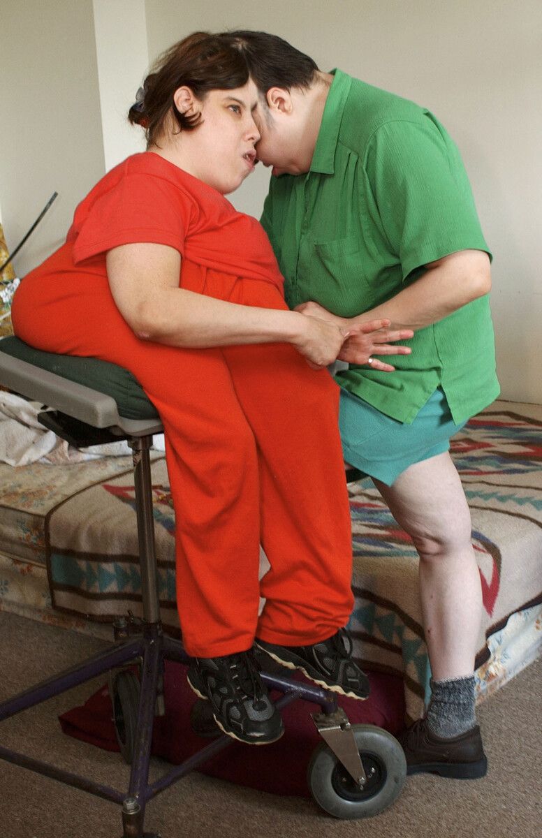 George und Lori Schappell wurden mehr als doppelt so alt, als die Ärzte dachten. ap