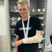 Bruch des Ellenbogens von Peter bei Portugal-Rundfahrt
