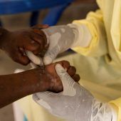 Mpox-Virus breitet sich aus