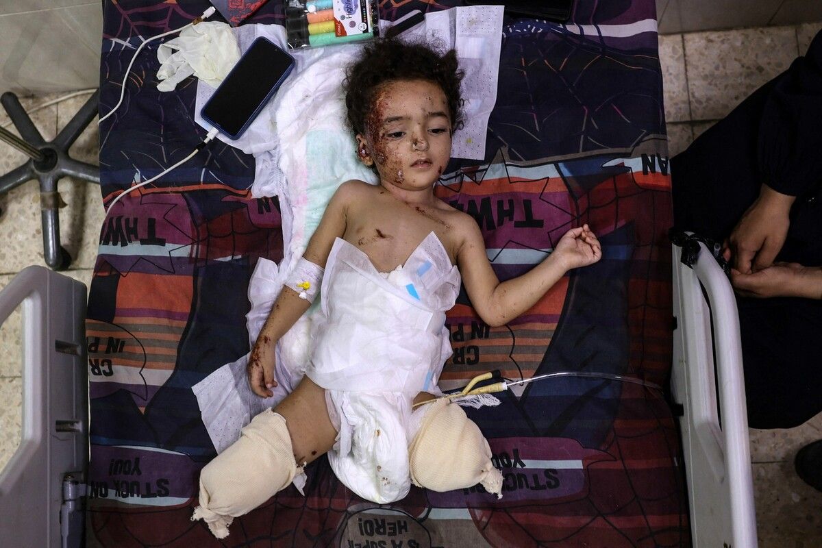 Die Hamas und das israelische Militär kämpfen seit dem Terroranschlag der Hamas am 7. Oktober 2023. Die Zivilbevölkerung leidet. AFP