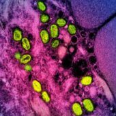 Erster bestätigter Fall der neuen Mpox-Variante in Deutschland