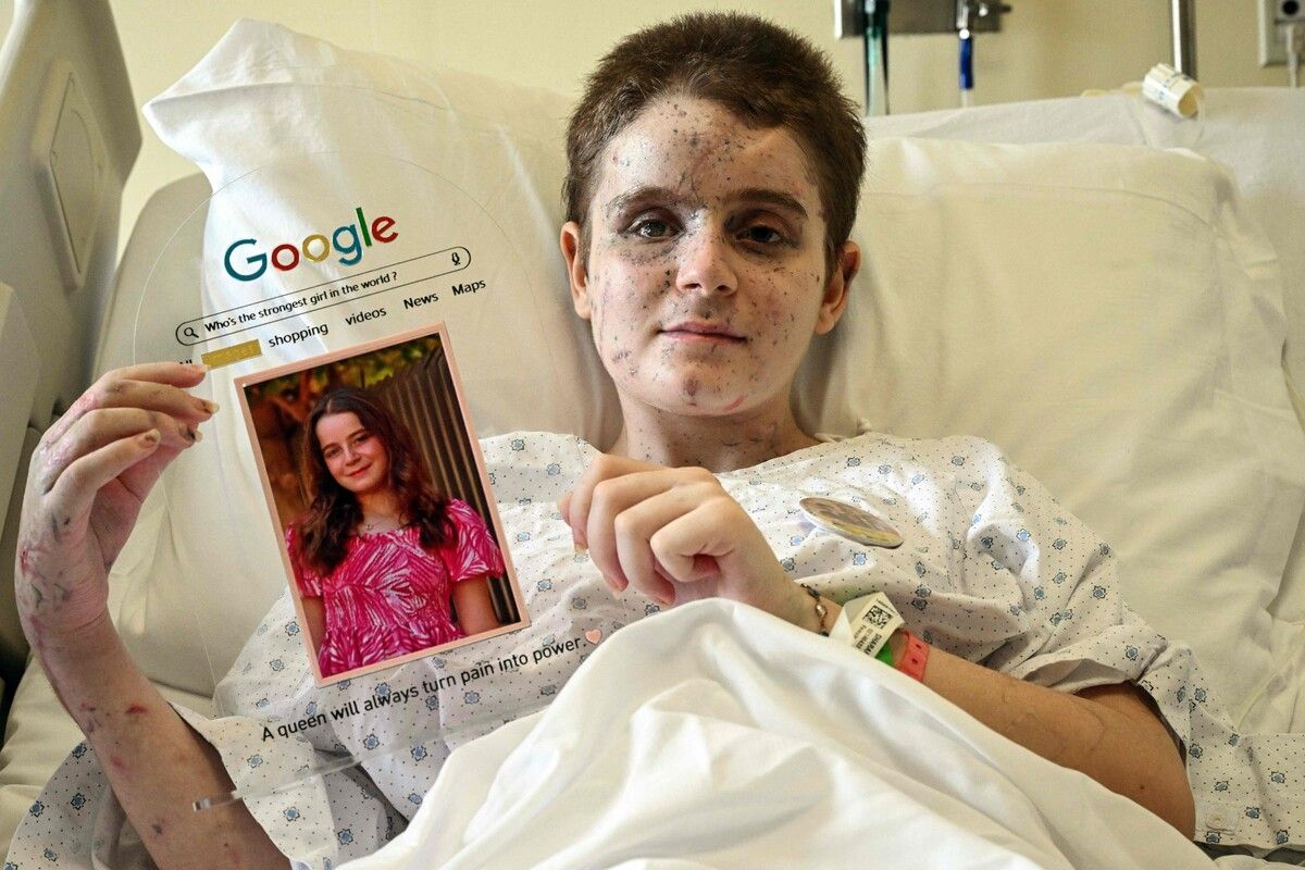 Die 13-jährige Aseel posiert in einem Krankenbett in Beirut mit einem Bild von sich vor ihren schweren Verletzungen durch einen israelischen Angriff.