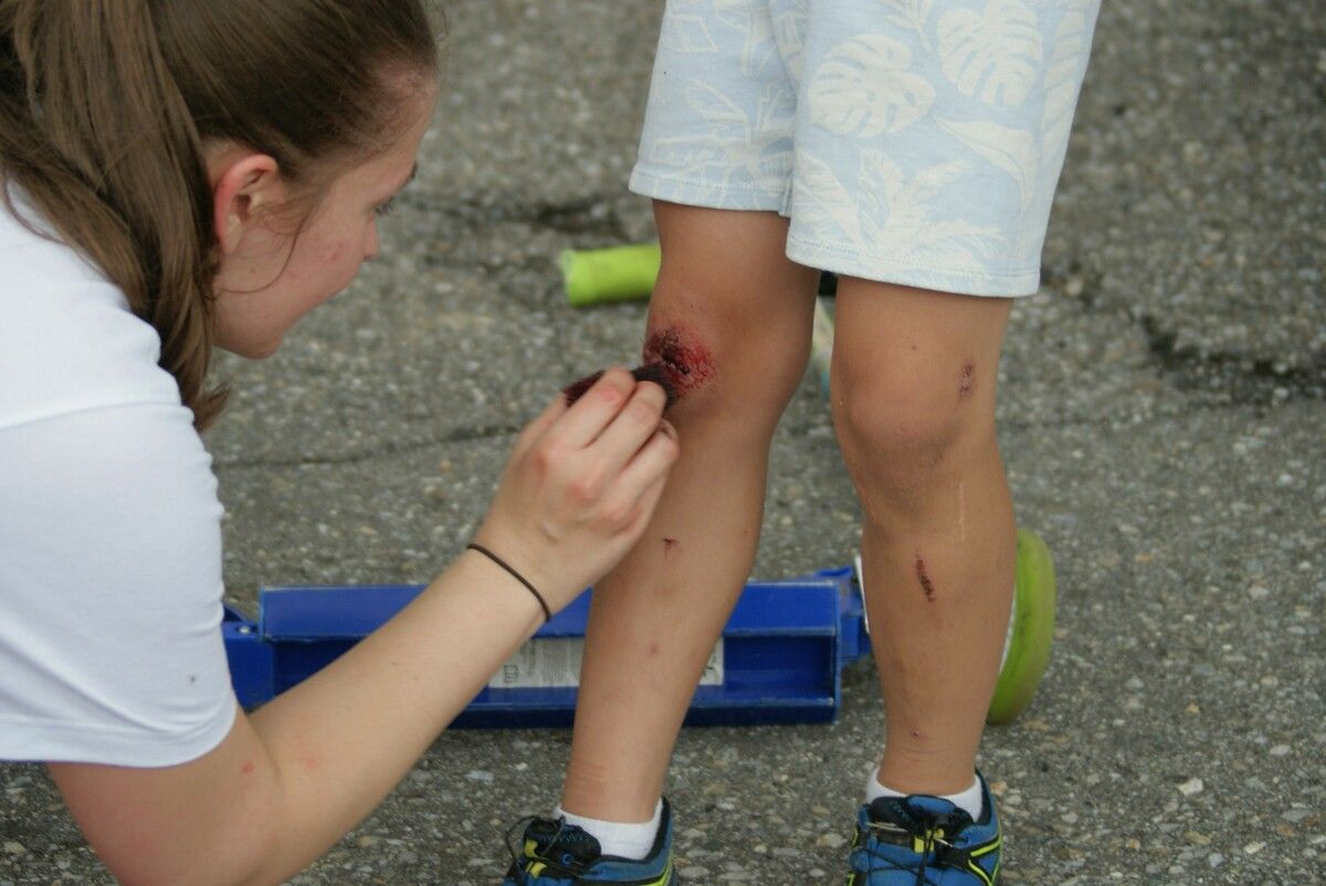 So glimpflich geht es bei Wunden nicht immer ab. Oft braucht es mehr. ⇒stocklasa