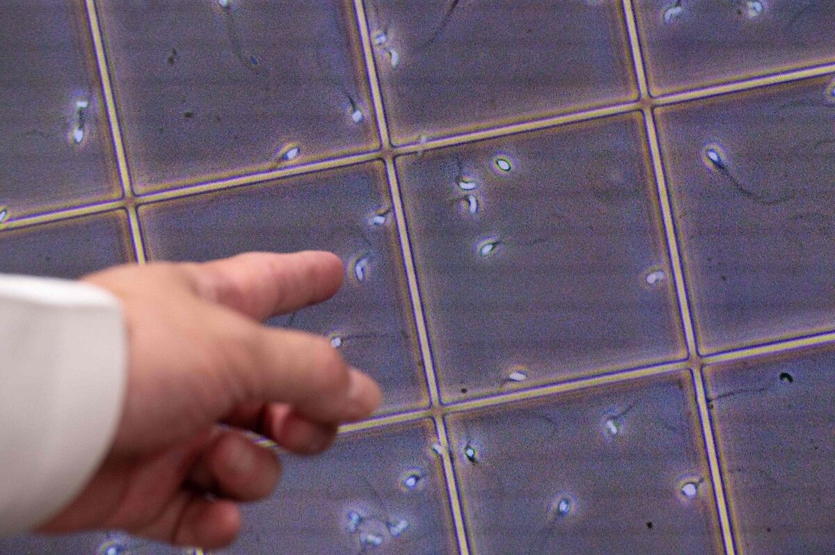 Der Gendefekt im Sperma des anonymen Spenders erhöht das Risiko von Krebserkrankungen erheblich.⇒AFP