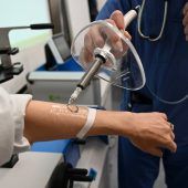 Schmerzfrei und zudem auch nachhaltig